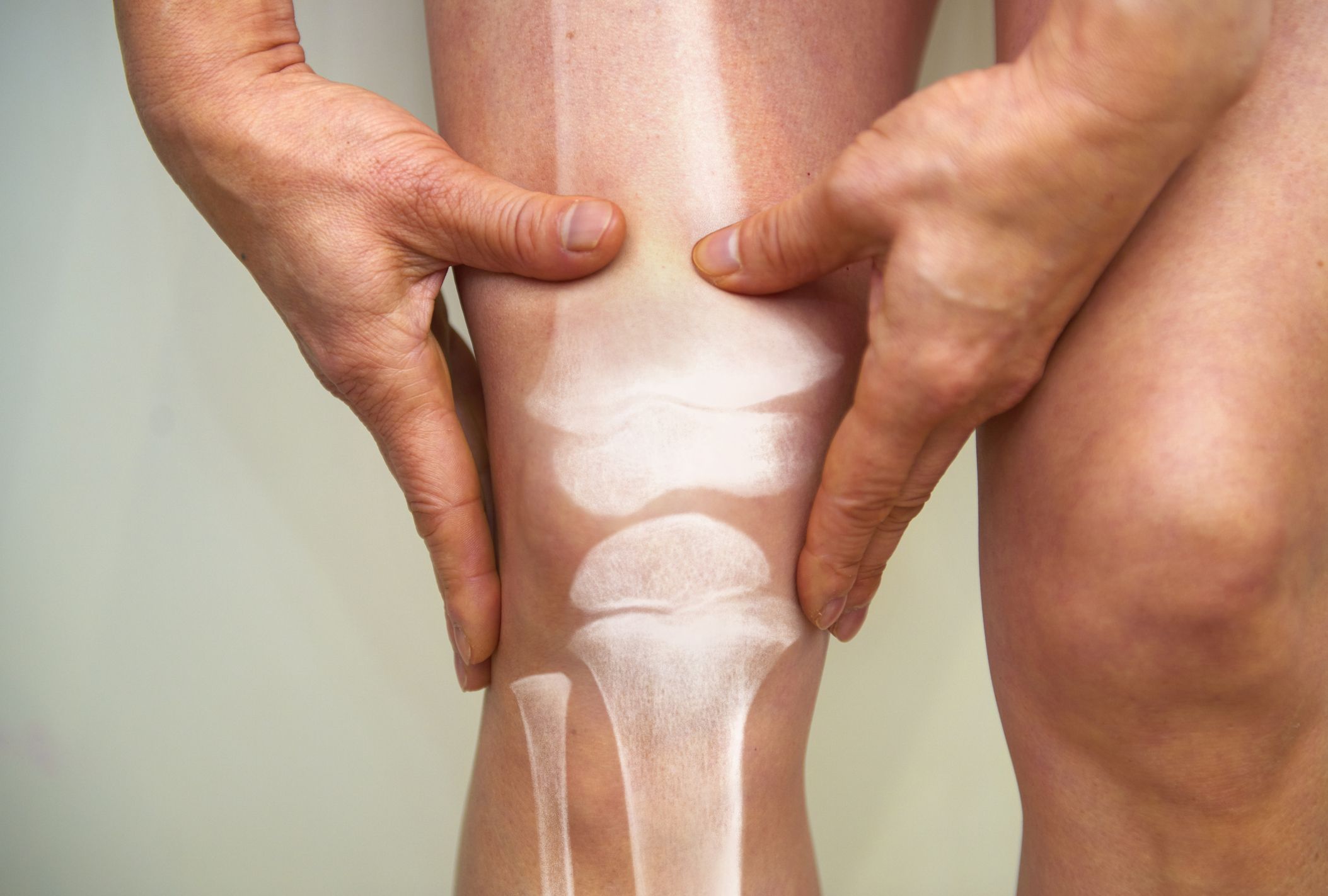¿Qué hacer para aliviar el dolor en las rodillas?